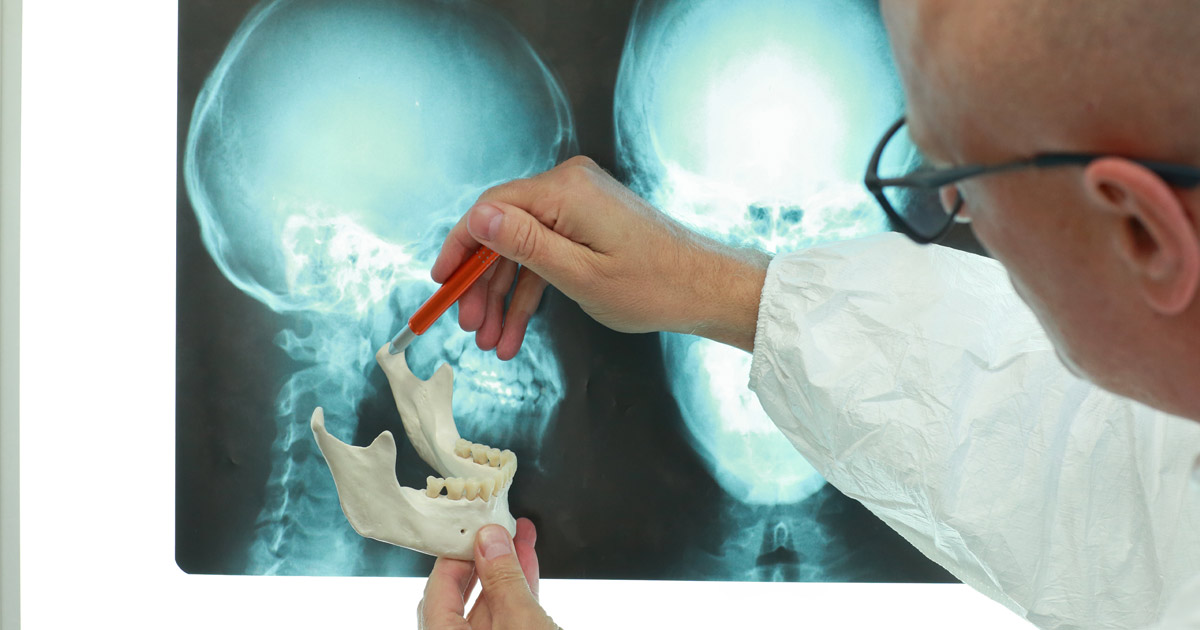 Dentist explaining common issues requiring oral surgery with x-ray
