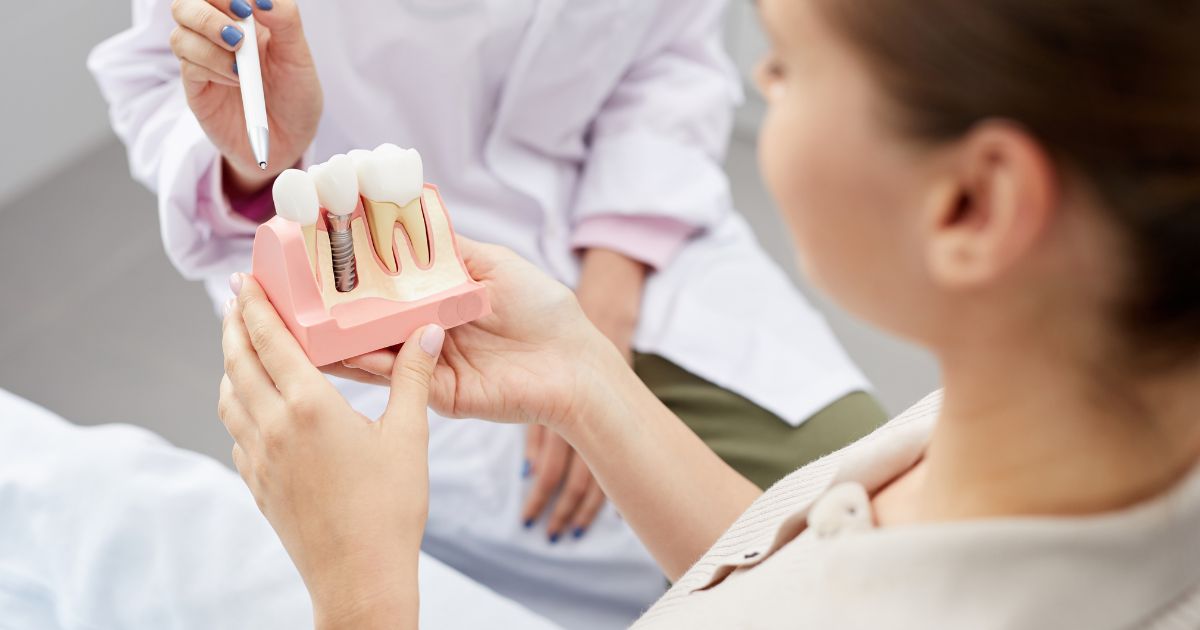 dental implants