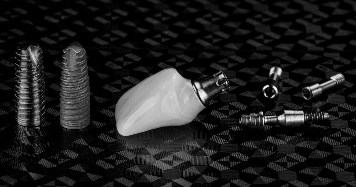 dental implants, repair/replace