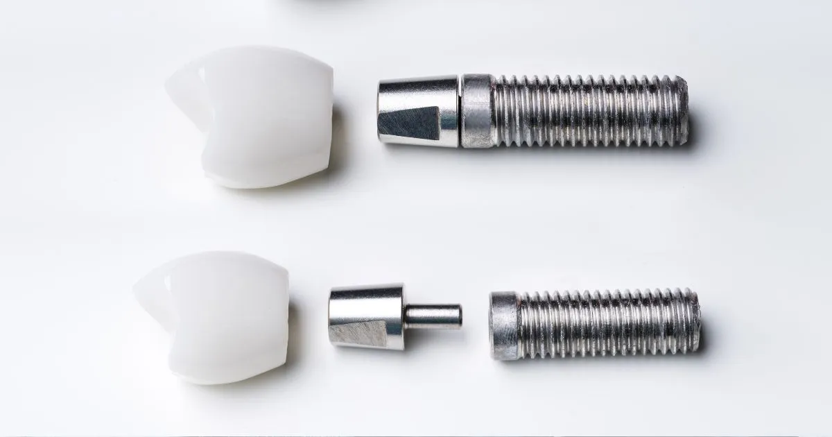 dental implant parts